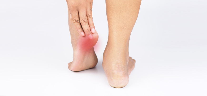 patient needing plantar fasciitis treatment in Santa Maria CA
