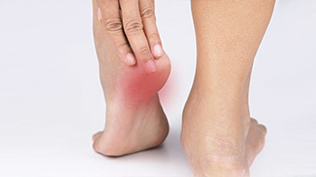 patient requiring plantar Fasciitis treatment in Santa Maria CA