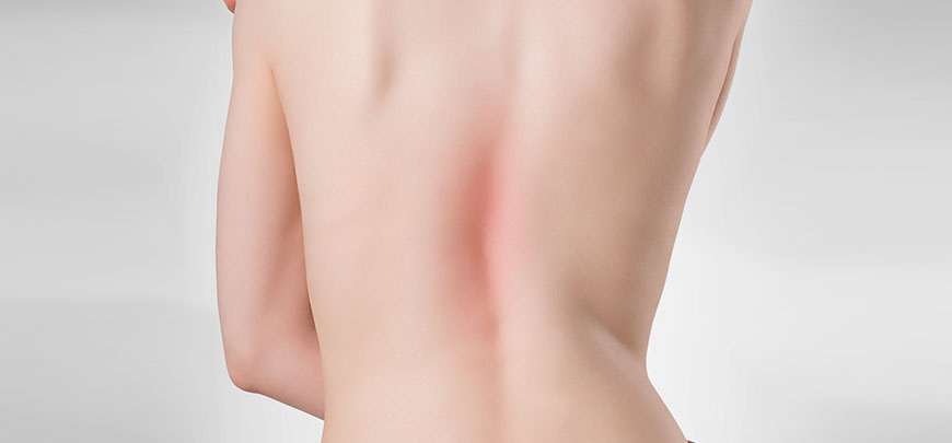 patient needing scoliosis treatment in Santa Maria CA